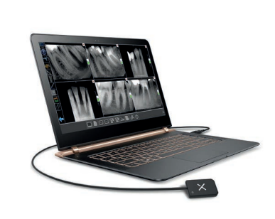 StarX PRO Intraoral Sensor (ASK FOR PRICE)