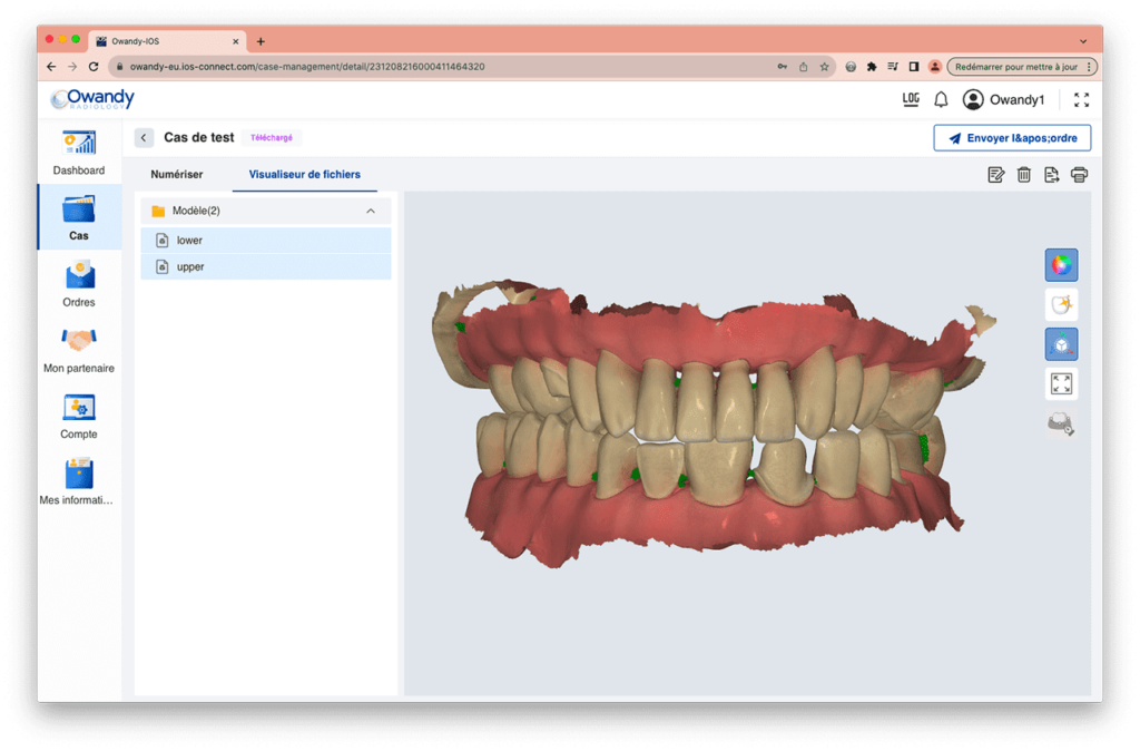 Owandy-IOS Intraoral Scanner (ASK FOR PRICE)