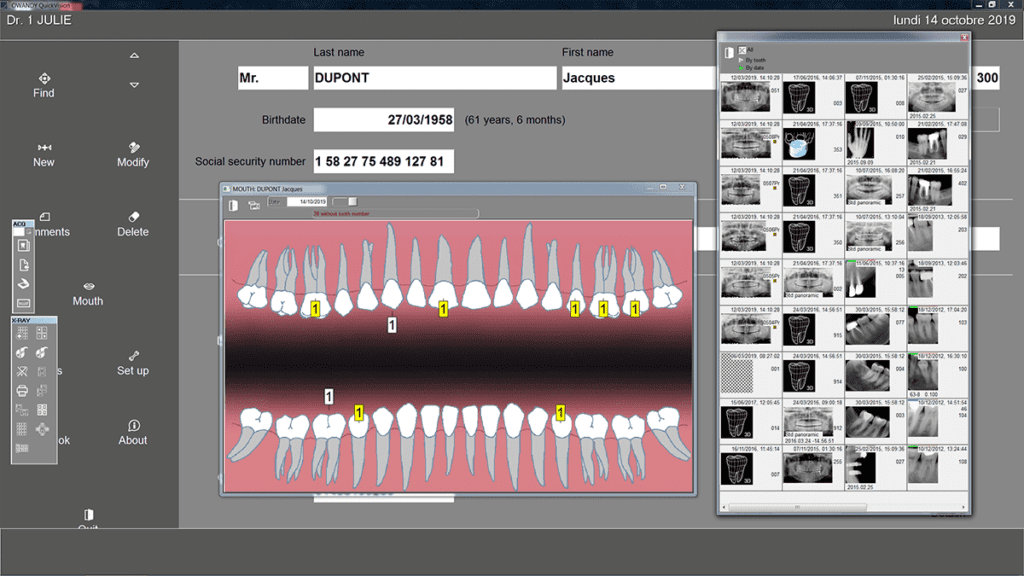 Owandy-CR2 Dental Plate Scanner (ASK FOR PRICE)